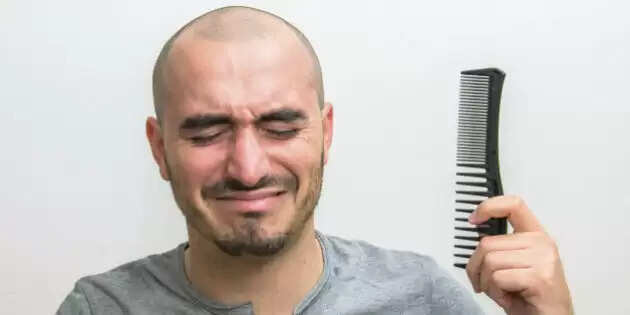 சொட்டைத் தலை அழகை குறைக்கிறதா? வழுக்கையை மறைக்க அற்புத மூலிகை போதும் !