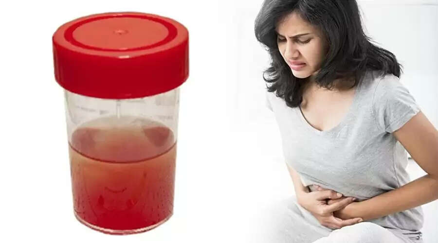 உங்க சிறுநீரின் கலரை பாருங்க ,உங்களுக்கிருக்கும் நோயை கண்டுபிடிங்க