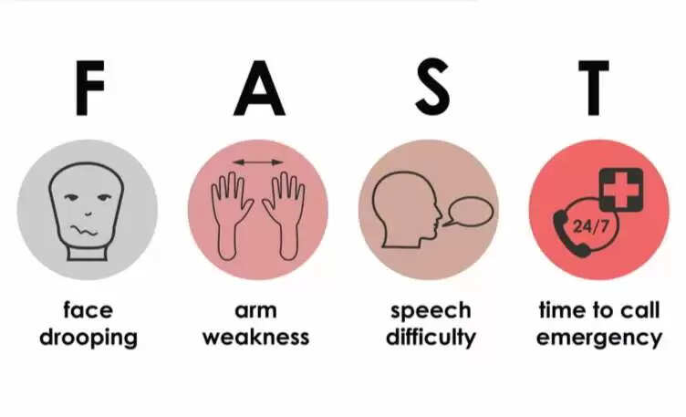 பக்கவாதம் – அறிகுறிகள் அறிவோம்!