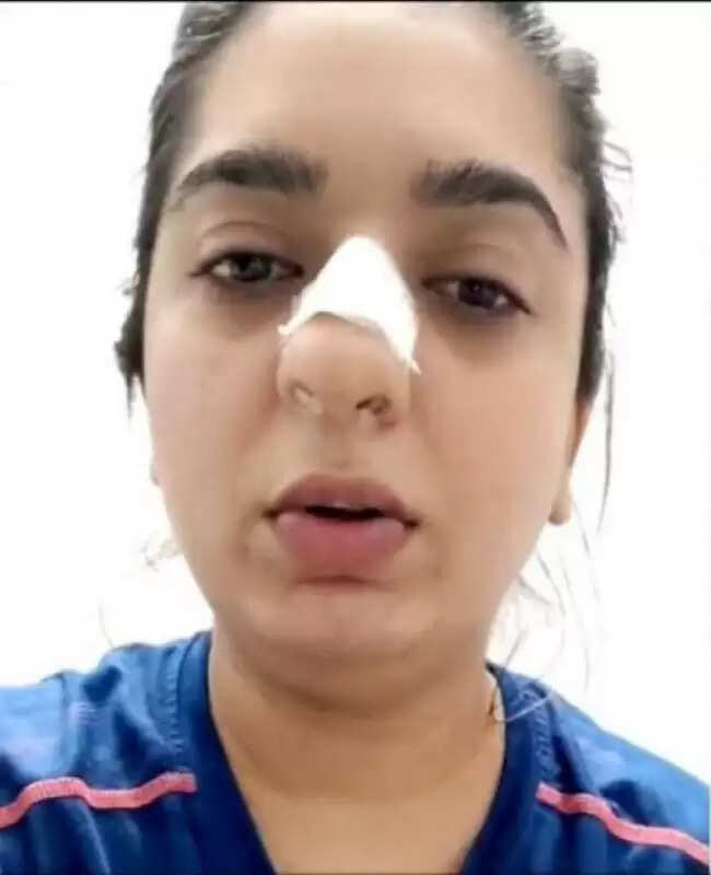 சொமேட்டா டெலிவரி பாயுடன் மோதி மூக்குடைபட்ட இளம்பெண் #zomatodeliveryboy