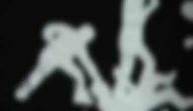 ஆவடி அருகே பயங்கரம் – சட்டக்கல்லூரி  மாணவருக்கு அரிவாள் வெட்டு