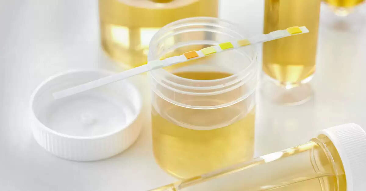 உங்களின் சிறுநீர் சொல்லும் முக்கியமான விஷயம்!