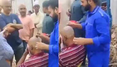 Hyderabad Barbers Bald Claim Magic Lotion Lands Many In Hospital