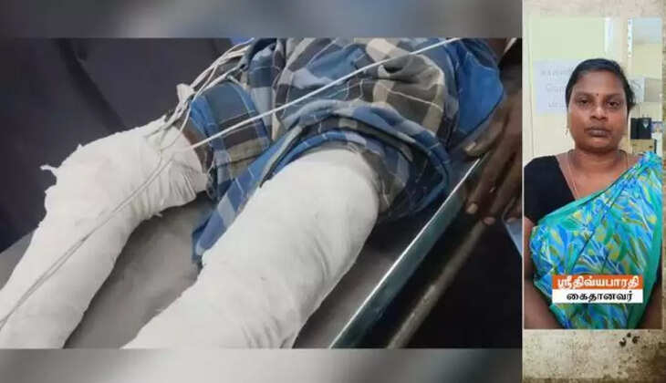 வேலைக்கு செல்லக்கூடாது எனக்கூறிய கணவன் காலில் கொதிக்கும் எண்ணெயை ஊற்றிய மனைவி