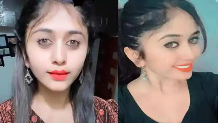 kannada actress plastic surgery