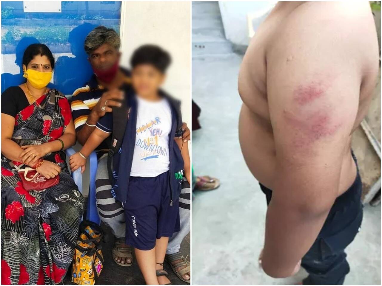 ஹோம்வொர்க் ஏன் செய்யல? யூகேஜி சிறுவனை அடித்த ஆசிரியை மீது நடவடிக்கை!!