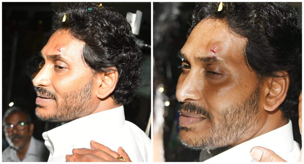 ஆந்திர முதல்வர் மீது கல்வீசி தாக்குதல் : துப்பு கொடுப்பவருக்கு சன்மானம் - காவல்துறை அதிரடி அறிவிப்பு!!