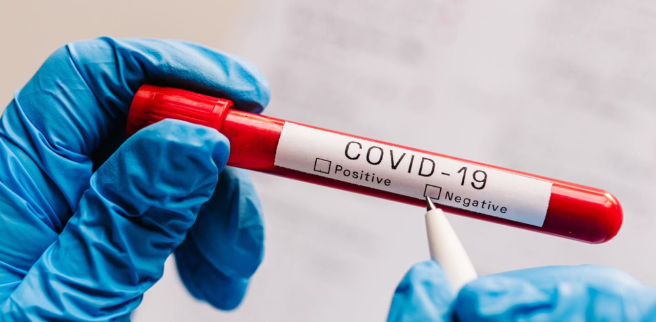 கொரோனா நெகடிவ் சான்றிதழ் கட்டாயம் - சீனா உள்ளிட்ட 6 நாடுகளில் இருந்து வரும் பயணிகளுக்கு கட்டுப்பாடு..