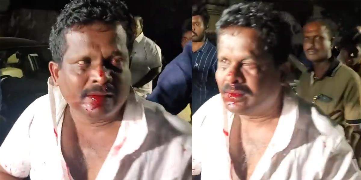 உருட்டுக்கட்டைகள்.. ரத்தம் சொட்ட சொட்ட.. சத்தியமூர்த்தி பவன் கலவரம்