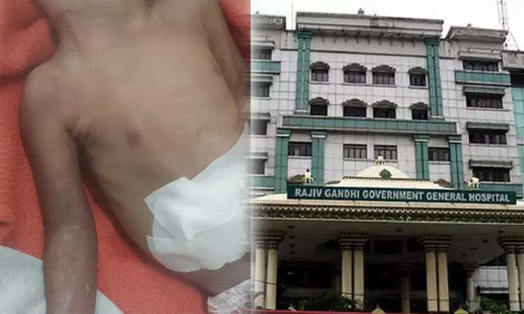 கை அகற்றப்பட்ட குழந்தை உயிரிழப்பு - மருத்துவமனை நிர்வாகம் விளக்கம்..