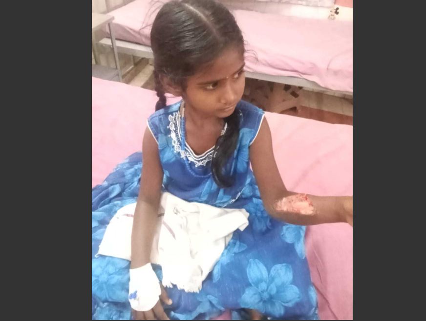 குச்சியால் தாக்கியதில் சிறுமிக்கு காயம்- ஆசிரியை பணியிடைநீக்கம்