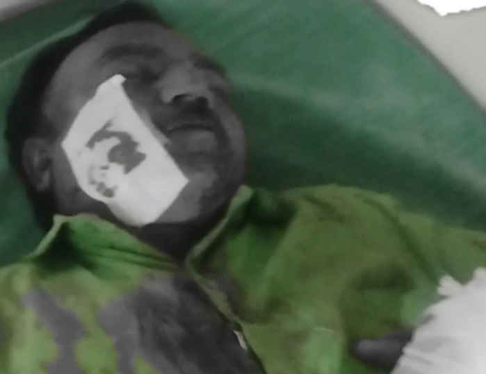 செஞ்சி அருகே நல்லாசிரியர் விருது பெற்ற ஆசிரியருக்கு அரிவாள் வெட்டு