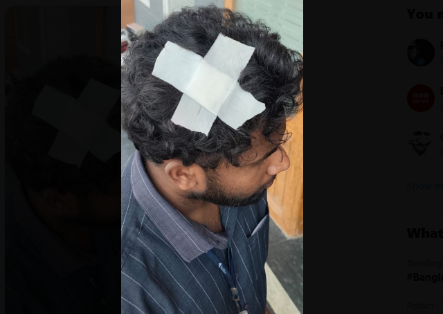 #BREAKING : மின்சார ரெயில் மீது மர்ம நபர்கள் கல்வீச்சு; பயணியின் தலையில் காயம்..!