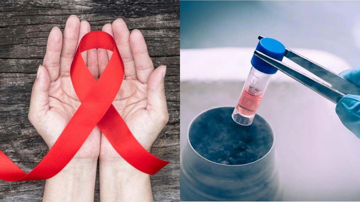 அடி தூள்.. எய்ட்ஸ் நோயிலிருந்து விடுபட்ட உலகிலேயே முதல் பெண் - ஸ்டெம் செல் சிகிச்சையில் மைல்கல்!